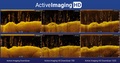 Lowrance Active Imaging HD FH2